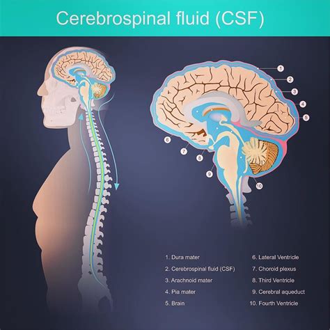 csf leaking from ears|Cerebrospinal Fluid Leak (CSF) Causes, Symptoms, & Treatment。